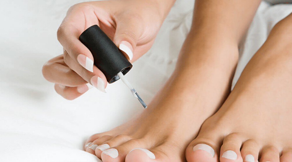 Behandlung von Pilzen am Daumen mit Nagellack