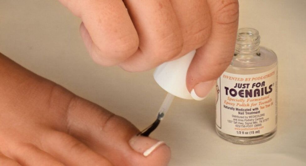 Nagellack gegen Pilz am großen Zeh