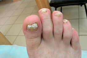 Finger auf den Fingern